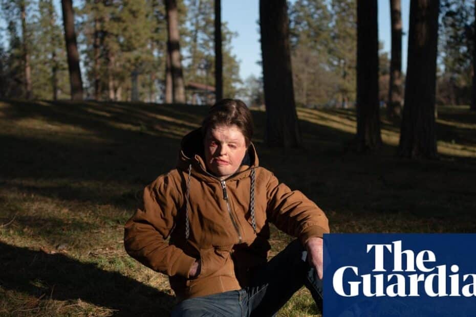 ผู้รอดชีวิตจากไฟไหม้